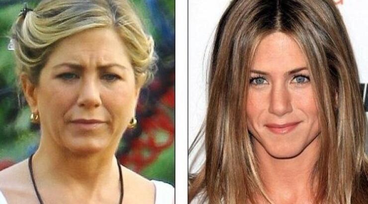 Απίστευτο! Πρήστηκε το πρόσωπο της Άνιστον!