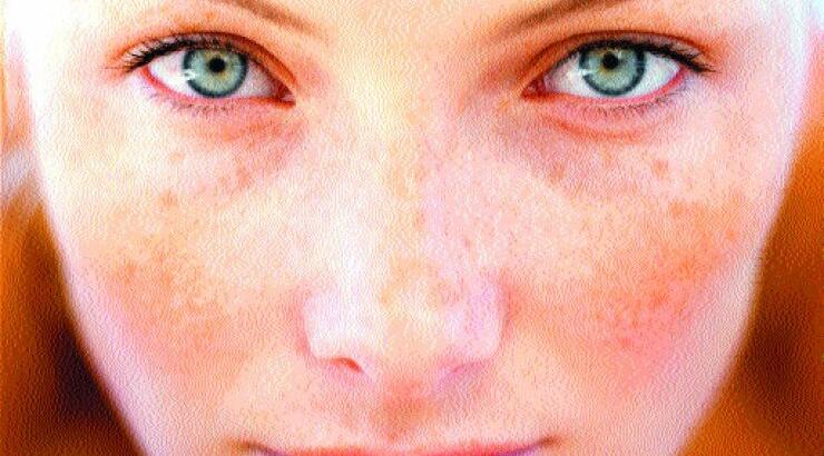 Face dots