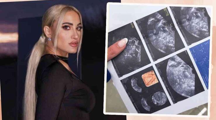 Τούνη: Ο υπέρηχος στον γυναικολόγο και τα 1000 μηνύματα που έλαβε σε ένα λεπτό [εικόνες]