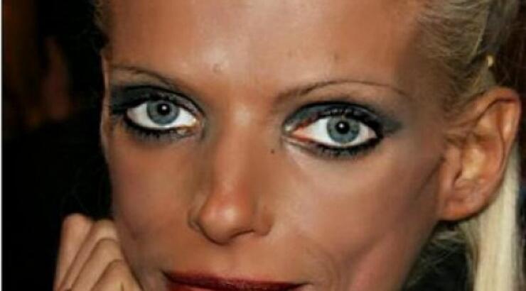 Μάχη με την ανορεξία: Δείτε πώς είναι σήμερα η Νανά Καραγιάννη