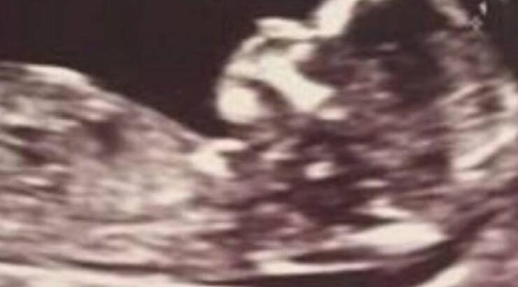 Κύπρια ηθοποιός ανακοίνωσε την εγκυμοσύνη της μετά από μια σκληρή μάχη με τον καρκίνο