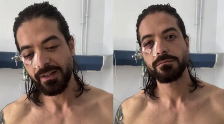 Άρης Μουγκοπέτρος: Εκτός από τα δύο δάκτυλα που έχασε έχει και σοβαρή βλάβη στο μάτι