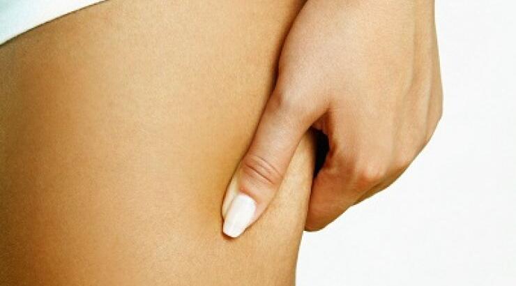 5 tips για να "γλυτώσεις" από την κυτταρίτιδα