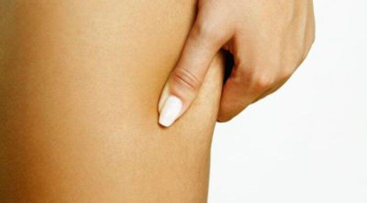 4 περίεργοι τρόποι αντιμετώπισης της κυτταρίτιδας που αποδίδουν 