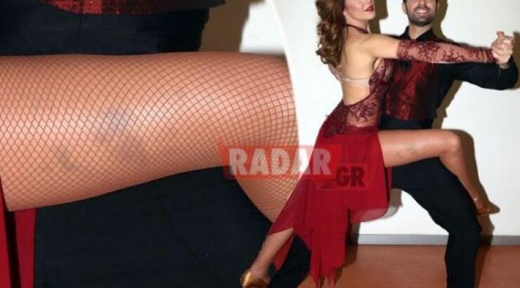 Ευγενία Μανωλίδου: Δείτε τις μελανιές στο πόδι της