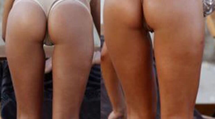 Ποια επώνυμη διαθέτει αυτό το καλλίγραμμο και σέξι κορμί; 