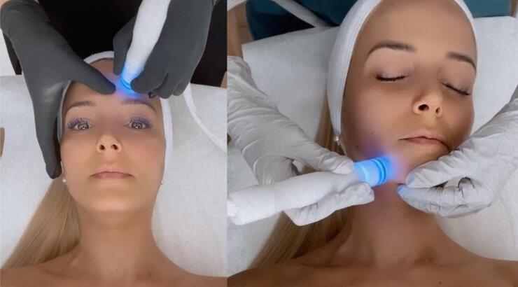 Nέο AQUA DERM+ : Η περιποίηση προσώπου που σου χαρίζει το Hollywood GLOW