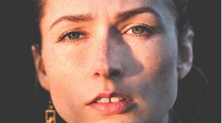 Μόλις έσπασε ένα σπυράκι; Αυτό πρέπει να κάνεις…