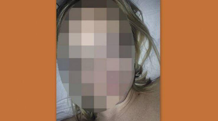 Προσοχή - σκληρό περιεχόμενο: Ηθοποιός τηλεοπτικής σειράς διεγνώσθη με καρκίνο στο δέρμα