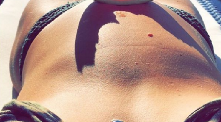 Πασίγνωστο μοντέλο κάνει ηλιοθεραπεία και μας δείχνει τη φουσκωμένη της κοιλίτσα!