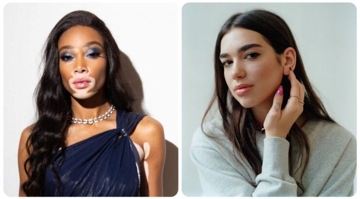 Κύπρια socialite ποζάρει με την Winnie Harlow και τη Dua Lipa! [εικόνες]