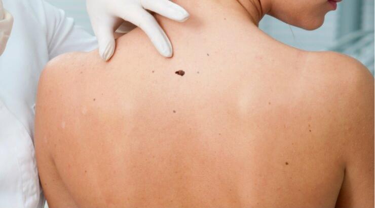 Μετά το καλοκαίρι κοιτάζω τις ελιές μου