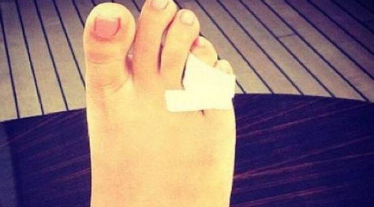 Ποιά διάσημη έσπασε το δάχτυλό της;