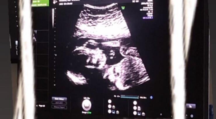 Κύπρια ηθοποιός μας αποκάλυψε την εγκυμοσύνη της δείχνοντάς μας το υπερηχογράφημα [εικόνα]