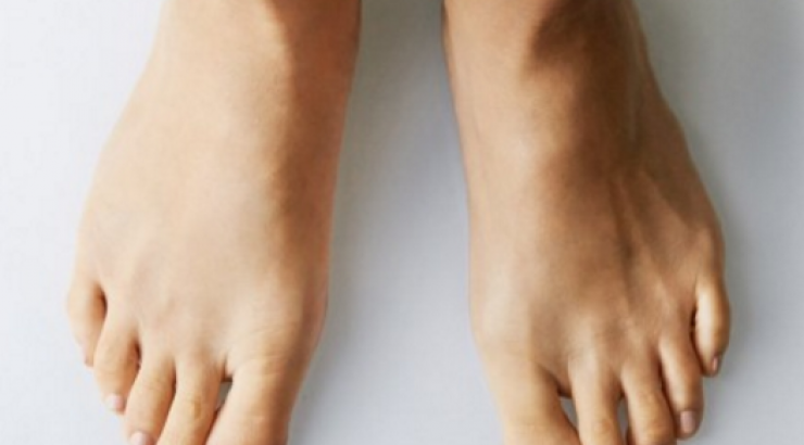 Αυτός είναι ο πραγματικός λόγος που δεν χάνετε κιλά!