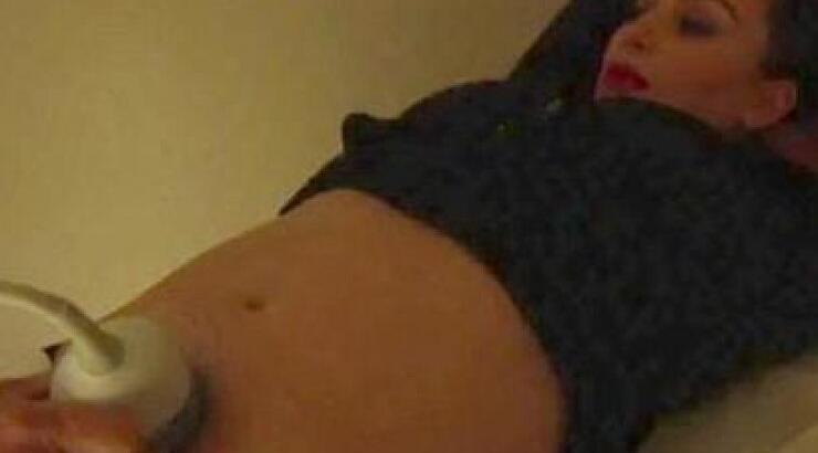 Kim Kardashian: Έκανε υπερηχογράφημα μπροστά στην κάμερα και έμαθε το φύλο του μωρού της!