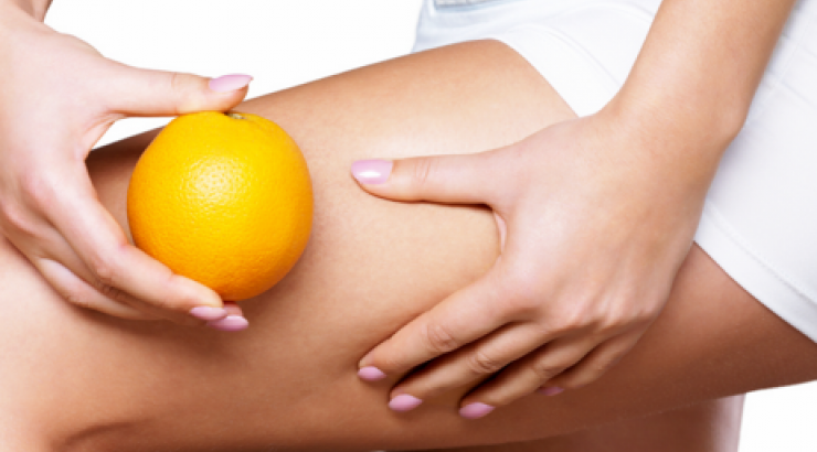 Πως εξαφανίζουν οι celebrities την κυτταρίτιδα;