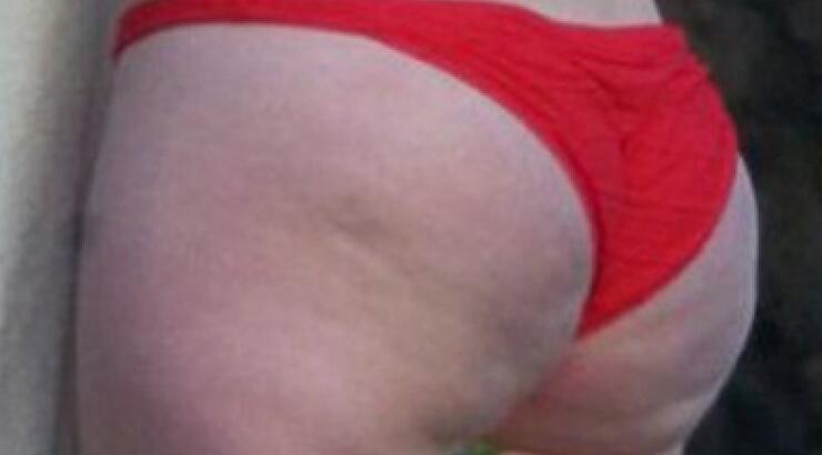 Φουλ στην κυτταρίτιδα! Σε ποια πασίγνωστη τραγουδίστρια ανήκουν αυτά τα οπίσθια;