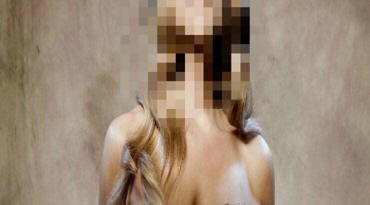 Ντόπερμαν δάγκωσε άσχημα ελληνίδα τραγουδίστρια