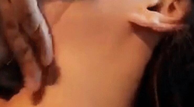 Πασίγνωστη ηθοποιός έκανε lifting και ανέβασε φωτογραφίες από την επέμβαση στα social media