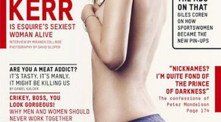 Μiranda Kerr: "Στην προηγούμενη ζωή μου, πρέπει να ήμουν κοάλα"