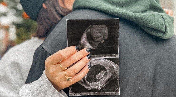 Γνωστό fashion girl του νησιού περιμένει το πρώτο της παιδί [εικόνες]