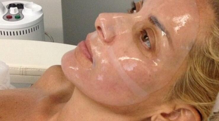  Η Ορθούλα Παπαδάκου κάνει… botox!