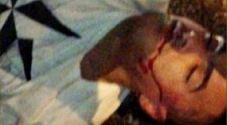 Σοκ! Γνωστός ποδοσφαιριστής αιμόφυρτος στο δρόμο μετά από καβγά