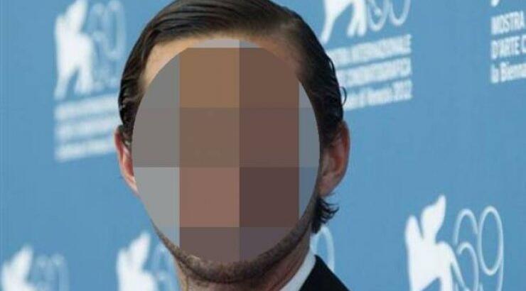 Απίστευτο! Διάσημος ηθοποιός έβγαλε μόνος του το δόντι του και αρνήθηκε να πλυθεί καθ’ όλη την διάρκεια των γυρισμάτων