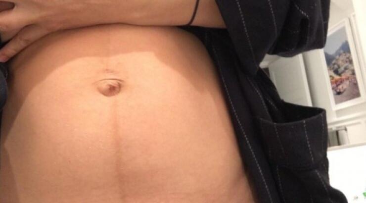 Πασίγνωστη ηθοποιός γέννησε πριν λίγες μέρες και μας δείχνει το σημάδι της καισαρικής τομής!