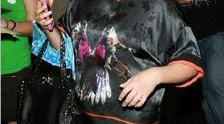 Απίστευτο! Δείτε ποια πασίγνωστη ηθοποιός κατάντησε έτσι! [βίντεο]