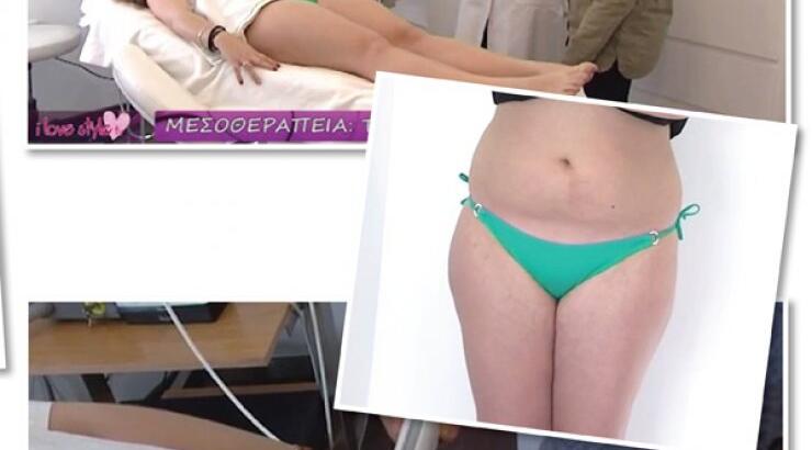 Μεσοθεραπεία: Μια νέα επαναστατική θεραπεία! [βίντεο]