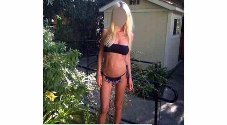 Σοκ με τις σκελετωμένες φωτογραφίες γνωστής ηθοποιού [εικόνες]