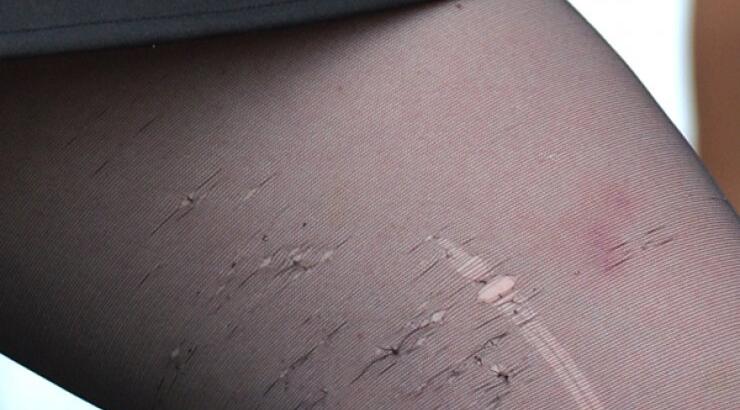 Ανερχόμενη τραγουδίστρια ανέβηκε στη σκηνή με σκισμένο καλτσόν [εικόνες]