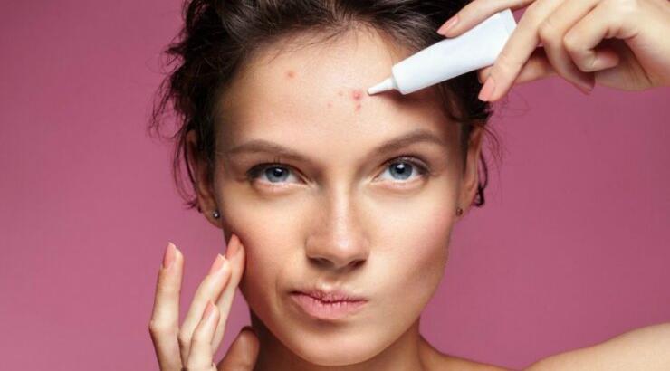 Τι μπορεί να δείχνει για την υγεία σου το σημείο του προσώπου που βγάζεις σπυράκια