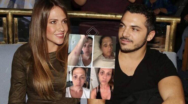 Δόξας - Δεληθανάση: Βγήκε το διαζύγιο τους - "Είδα πως είναι να μην είσαι φίλος με τους φίλους σου"