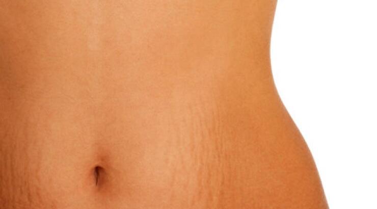 Ραγάδες: Τι είναι και γιατί δεν μας εγκαταλείπουν