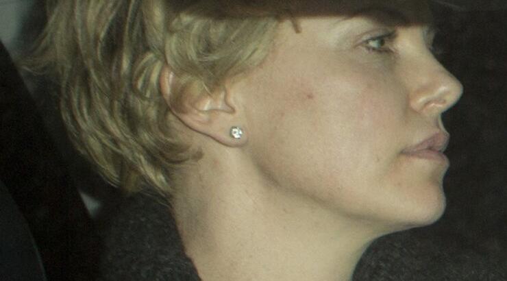 Charlize Theron: Το σημάδι στο λαιμό!!!