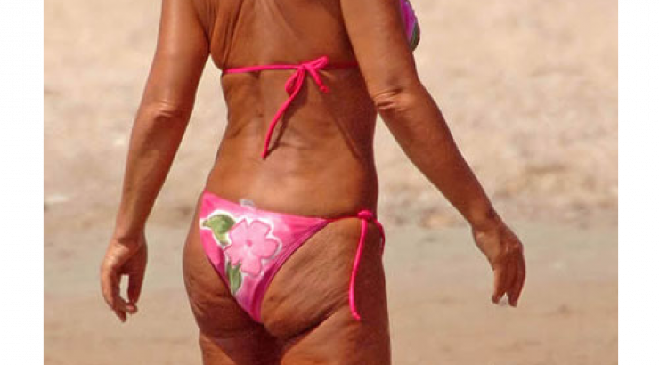 Η κυτταρίτιδα έφτασε μέχρι τον λαιμό! 