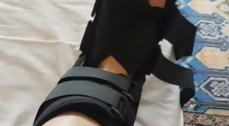 Το τραυματισμένο πόδι Ελληνίδας παρουσιάστριας! [βίντεο]