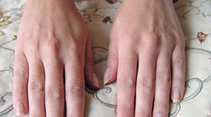 Στα άκρα: Αυτό είναι το μοντέλο που κερδίζει χρήματα ως μοντέλο χεριών