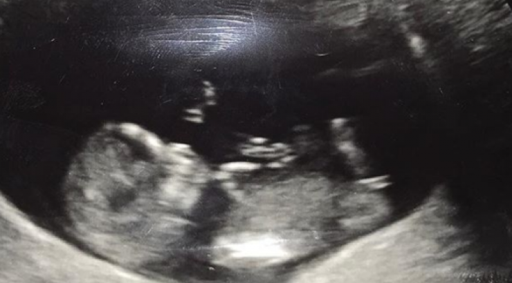 Γνωστός τραγουδιστής θα γίνει μπαμπάς για δεύτερη φορά!