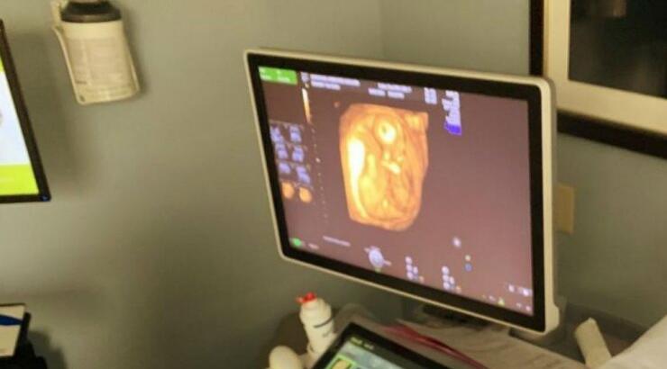 Ευχάριστα νέα στη showbiz! Γνωστό μοντέλο έγκυος για δεύτερη φορά! 