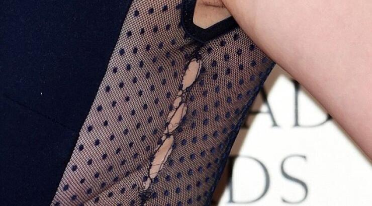 Ηθοποιός στο κόκκινο χαλί των BAFTA με σκισμένο φόρεμα [εικόνες]