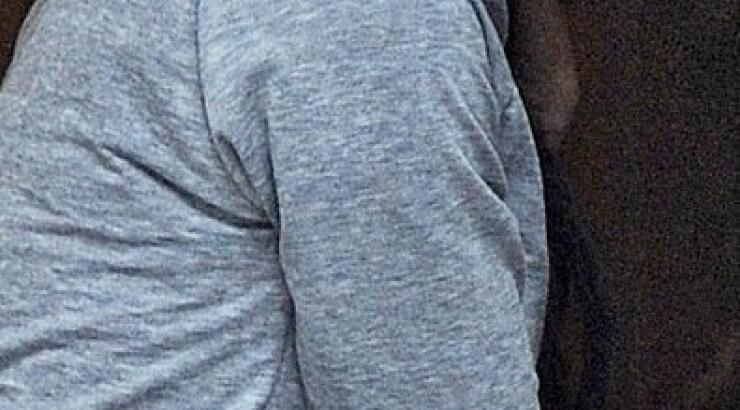 Δείτε μία από τις ωραιότερες γυναίκες του πλανήτη άβαφτη με σπυριά και μαύρους κύκλους