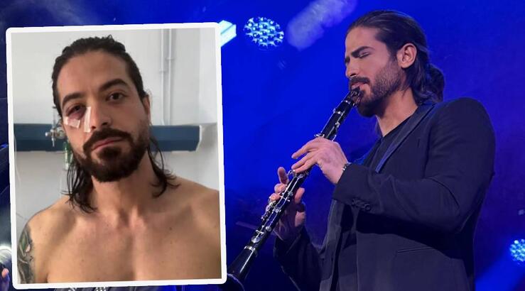 Άρης Μουγκοπέτρος: Τα πρώτα λόγια του μουσικού μέσα από το νοσοκομείο μετά το ατύχημα [βίντεο]