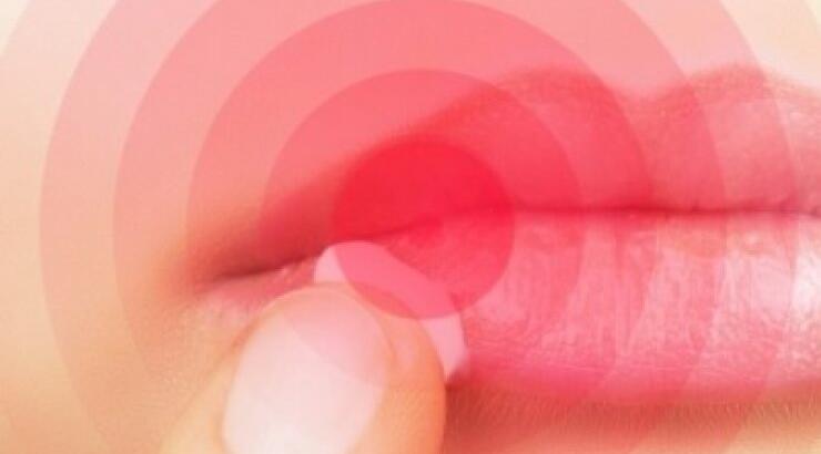  Επιχείλιος έρπης: Πώς να τον διώξετε πιο γρήγορα 