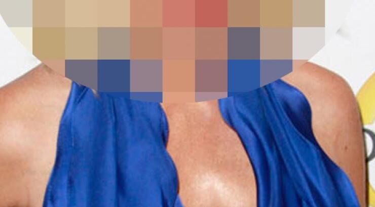 Πασίγνωστη ηθοποιός: "Τα εμφυτεύματα στήθους έληξαν και πρέπει να βάλω άλλα!"