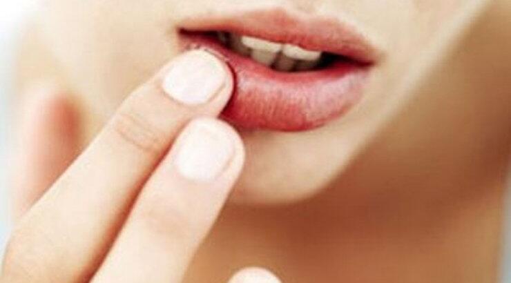 Γιατί το χειμώνα σκάνε τα χείλη;