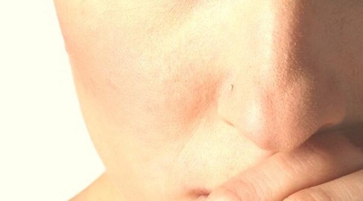 Θεραπεία: Η 